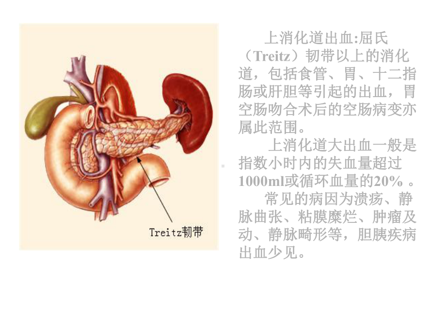 上消化道出血的诊断及内镜下治疗课件.ppt_第2页