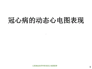 心肌缺血发作时的动态心电图规律课件.ppt