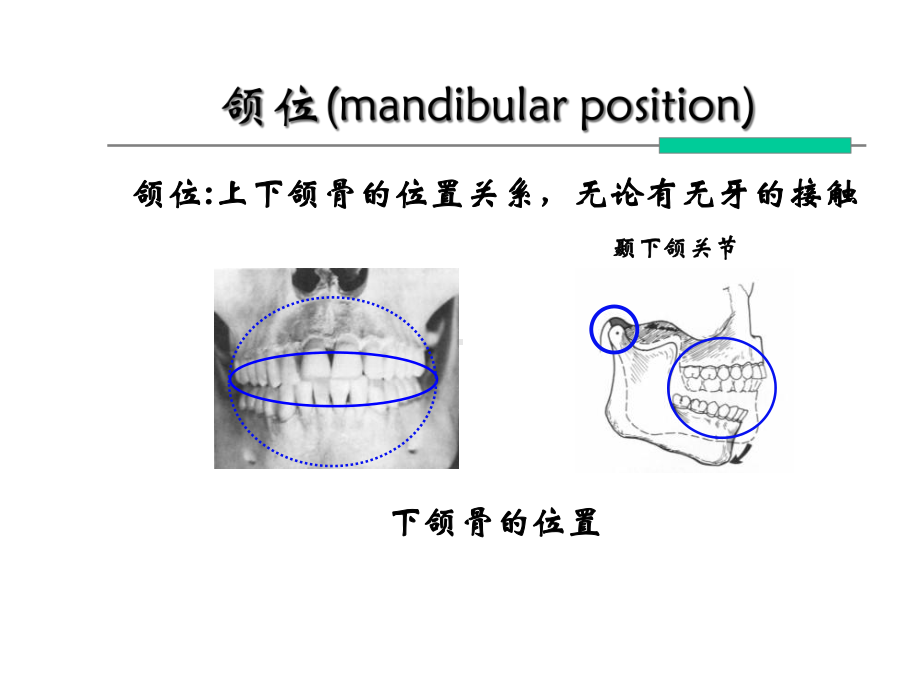 口腔解剖学：颌位与下颌运动课件.ppt_第2页