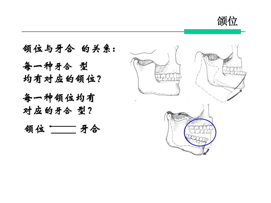 口腔解剖学：颌位与下颌运动课件.ppt_第3页