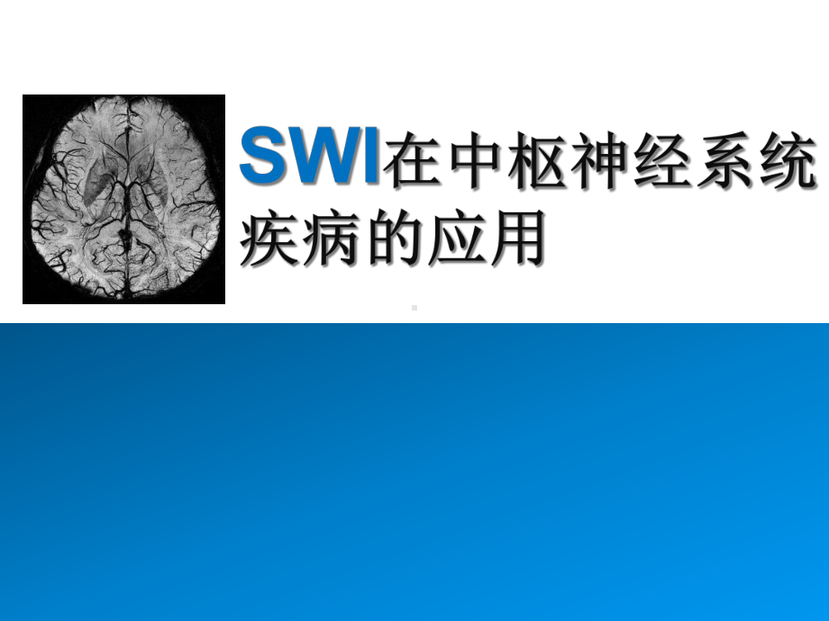 SWI在中枢神经系统疾病的应用课件.ppt_第1页