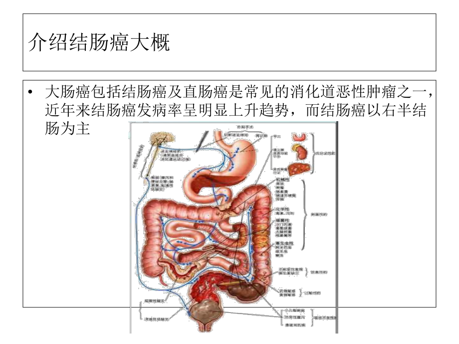 恶性肿瘤病人常见症状的护理课件.ppt_第3页