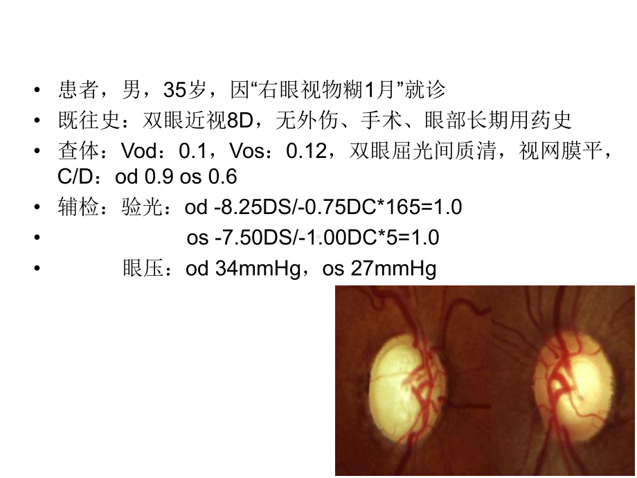 2021推荐AAO原发性开角型青光眼课件.ppt_第2页