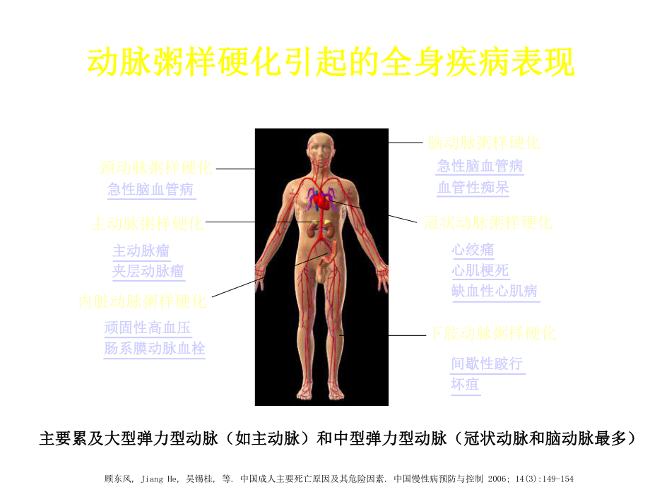 (优选)全面干预动脉粥样硬化全过程课件.ppt_第3页