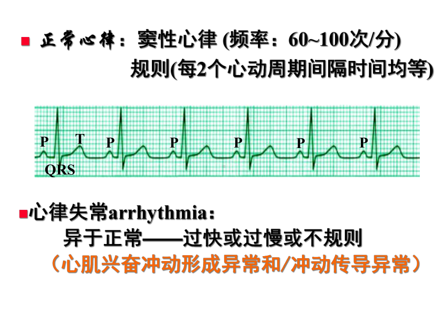 抗心律失常药课件.pptx_第2页