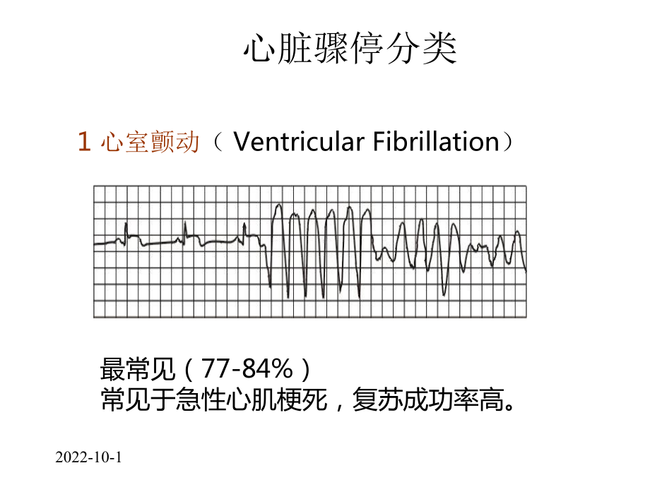 2021新版心肺复苏CPR操作技术课件.pptx_第3页