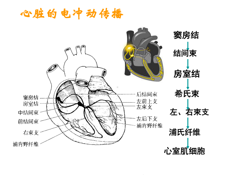 常见心电图危急值及处理(共47张)课件.pptx_第2页