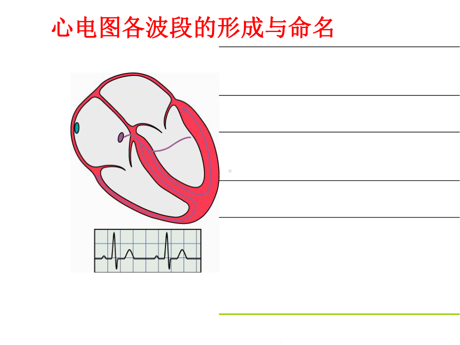 常见心电图危急值及处理(共47张)课件.pptx_第3页