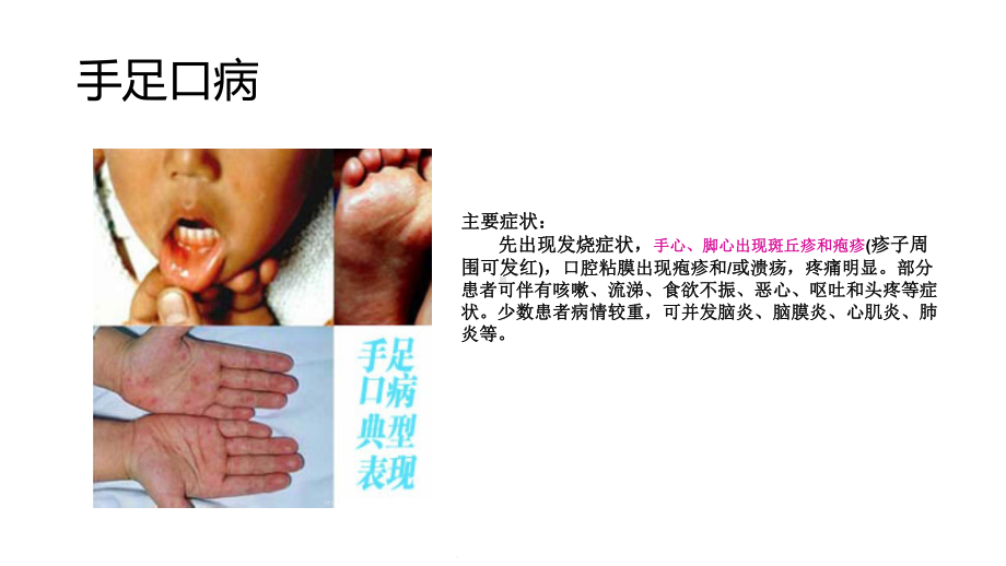 幼儿园传染病健康教育(共15张)课件.ppt_第3页