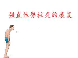 强直性脊柱炎课件.ppt