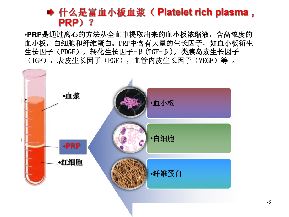 prp治疗难愈性创面课件.pptx_第2页