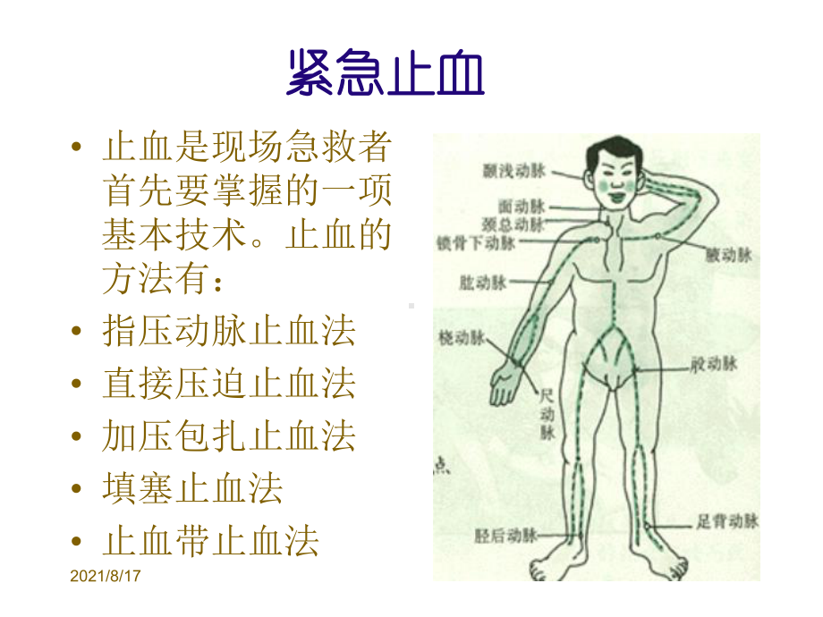 外伤止血包扎固定术课件.ppt_第3页