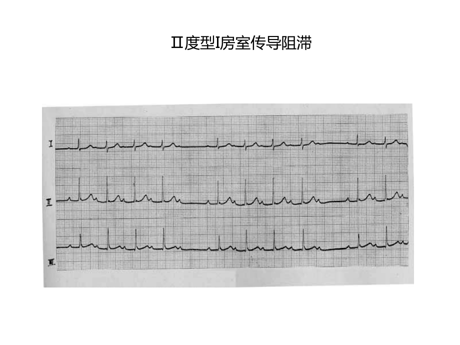 心电图及影像考试题答案课件.ppt_第2页