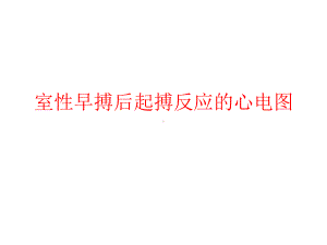 室性早搏后起搏反应的心电图共57张课件.ppt