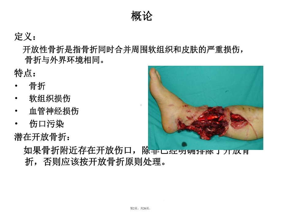 开放性骨折的治疗原则(共26张)课件.pptx_第2页