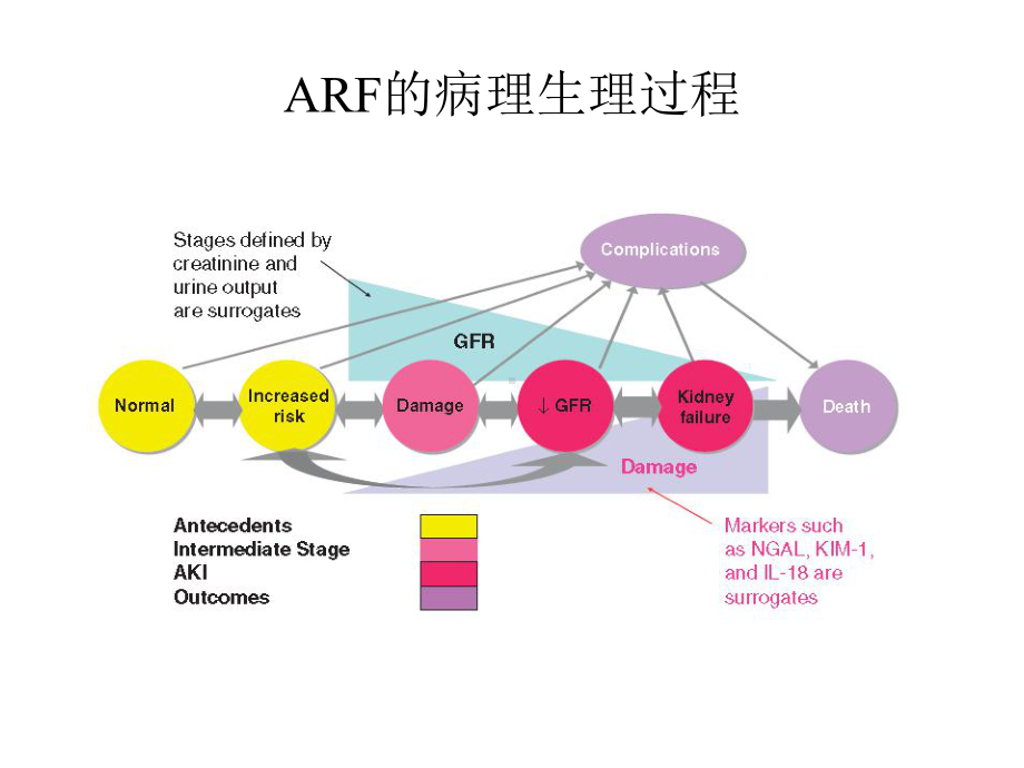 急性肾损伤诊断标准进展课件.pptx_第3页