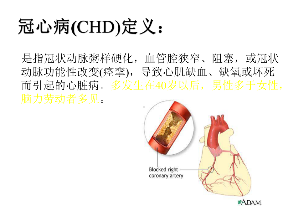 心绞痛病人护理课件.ppt_第3页