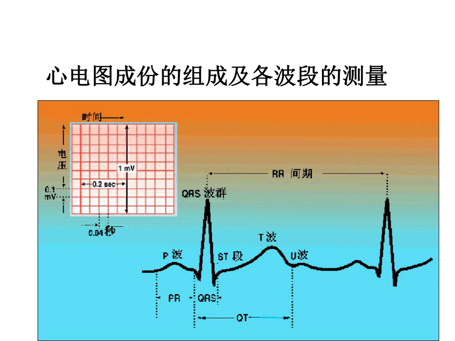 常见异常心电图课件.ppt_第2页