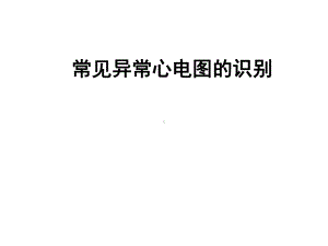 常见异常心电图课件.ppt