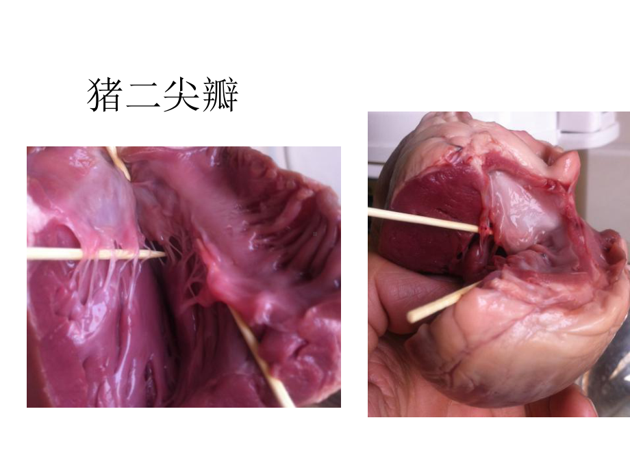 心脏瓣膜病内科学第第二篇[可修改版]课件.ppt_第2页