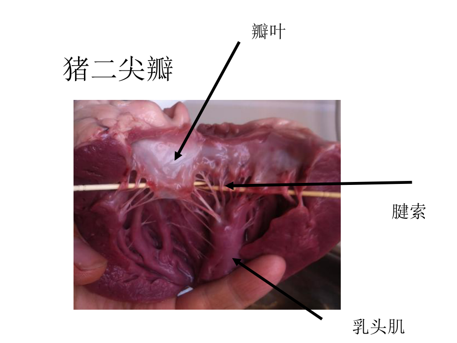 心脏瓣膜病内科学第第二篇[可修改版]课件.ppt_第3页