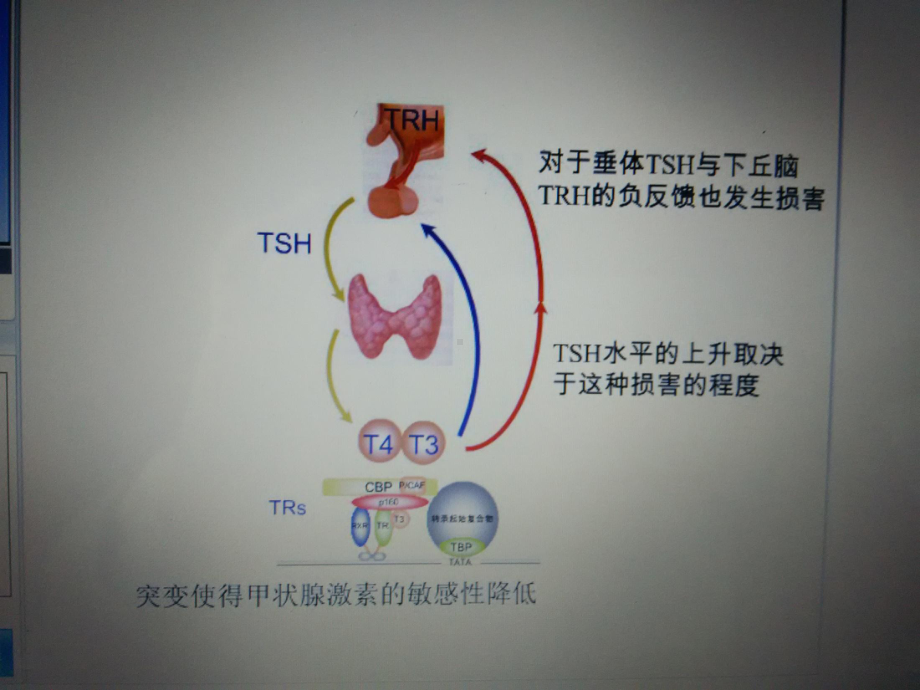 甲状腺激素抵抗综合征课件.ppt_第2页