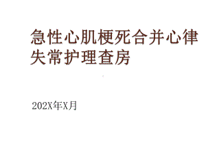 急性心肌梗死合并心律失常护理查房课件.pptx