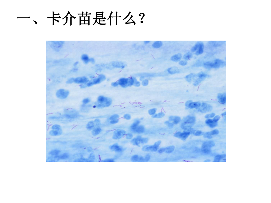 卡介苗接种技术培训课件.ppt_第3页