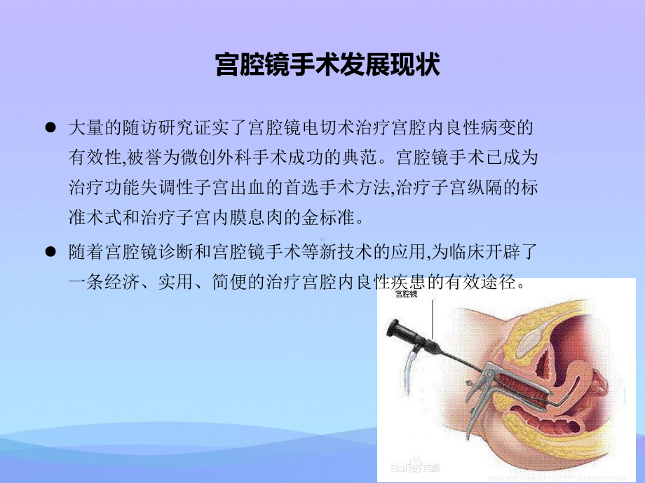 宫腔镜手术的并发症及护理措施课件.pptx_第3页