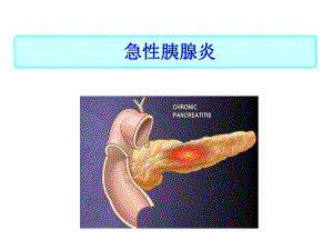 消化系统疾病病人护理课件.ppt