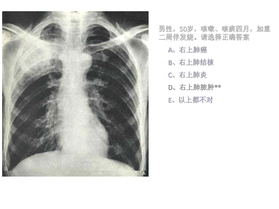 执业医师技能考试第三站测试题目课件.ppt_第3页