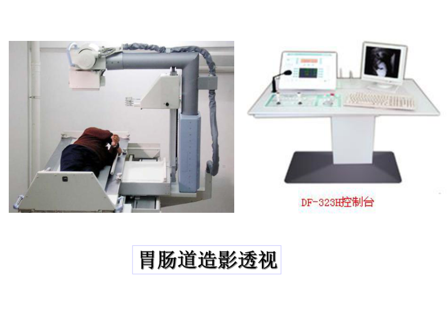 消化系统影像学课件.ppt_第3页