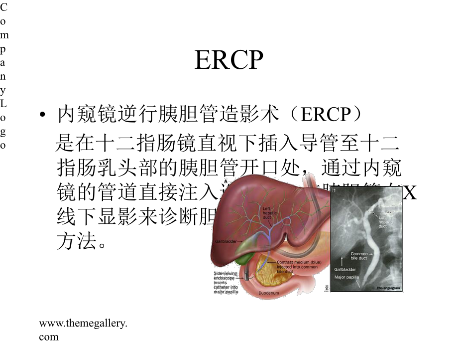 ercp诊疗与并发症课件.pptx_第1页