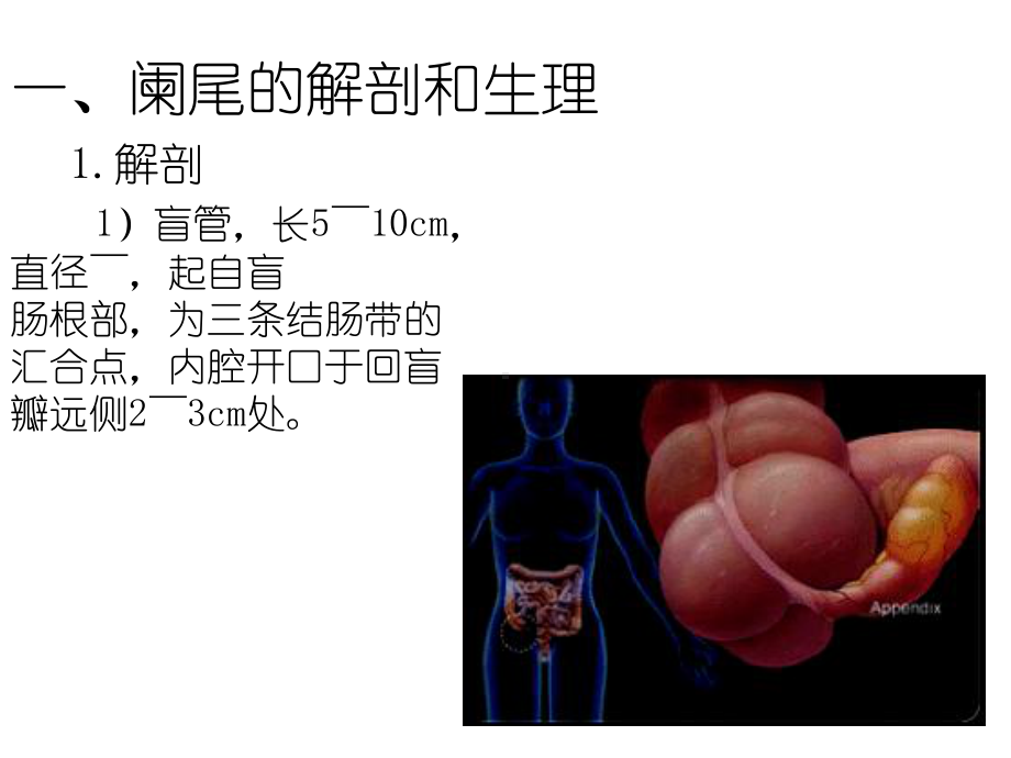 急性阑尾炎教学查房课件.ppt_第3页