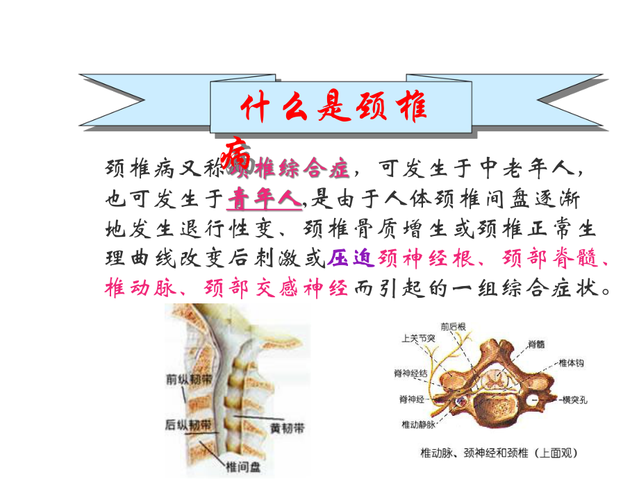 白领颈椎病的防治课件.ppt_第2页