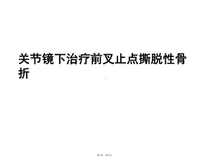 关节镜下治疗前叉止点撕脱性骨折(介绍：治疗)共61张课件.pptx