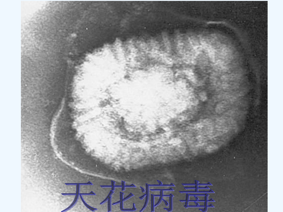 传染病的发生和预防课件.ppt_第3页