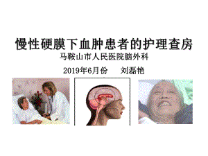 慢性硬膜下血肿护理查房医学课件.ppt