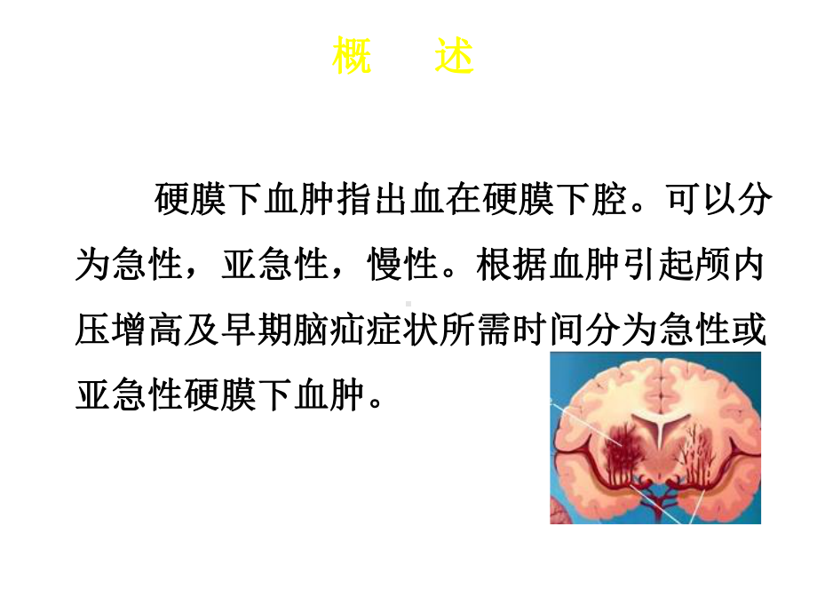 慢性硬膜下血肿护理查房医学课件.ppt_第2页