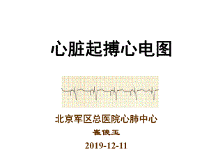 心脏起搏心电图-2课件.ppt