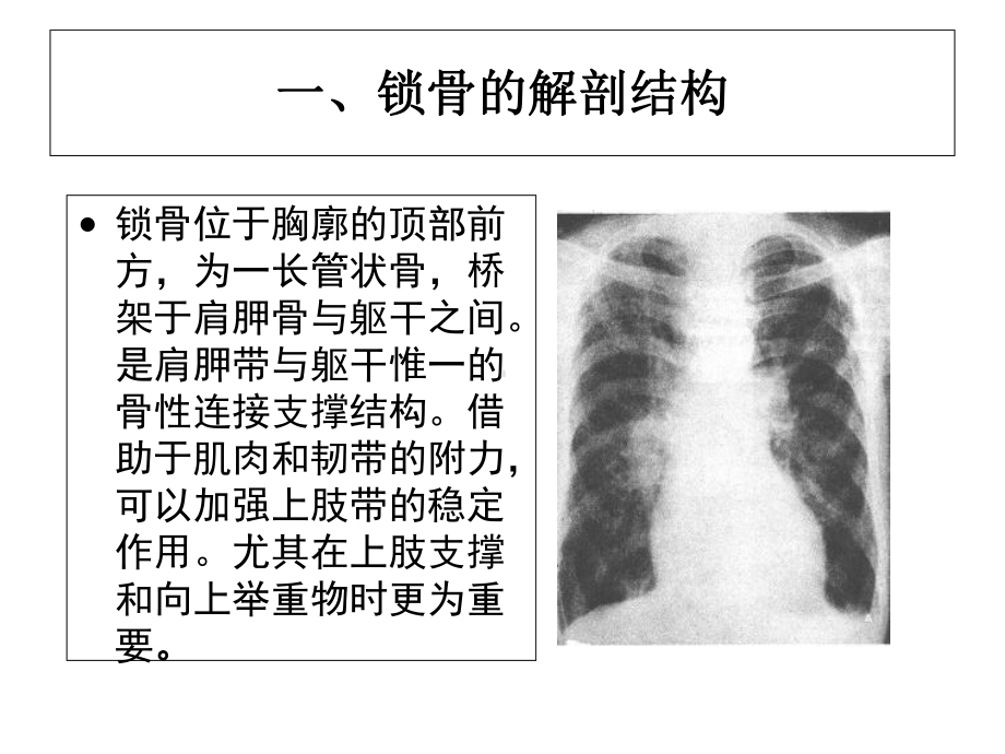 （完整版）锁骨骨折护理查房课件.ppt_第3页