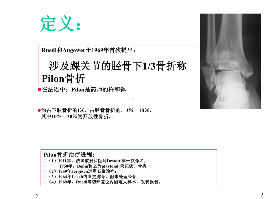 Pilon骨折的治疗课件.ppt_第2页