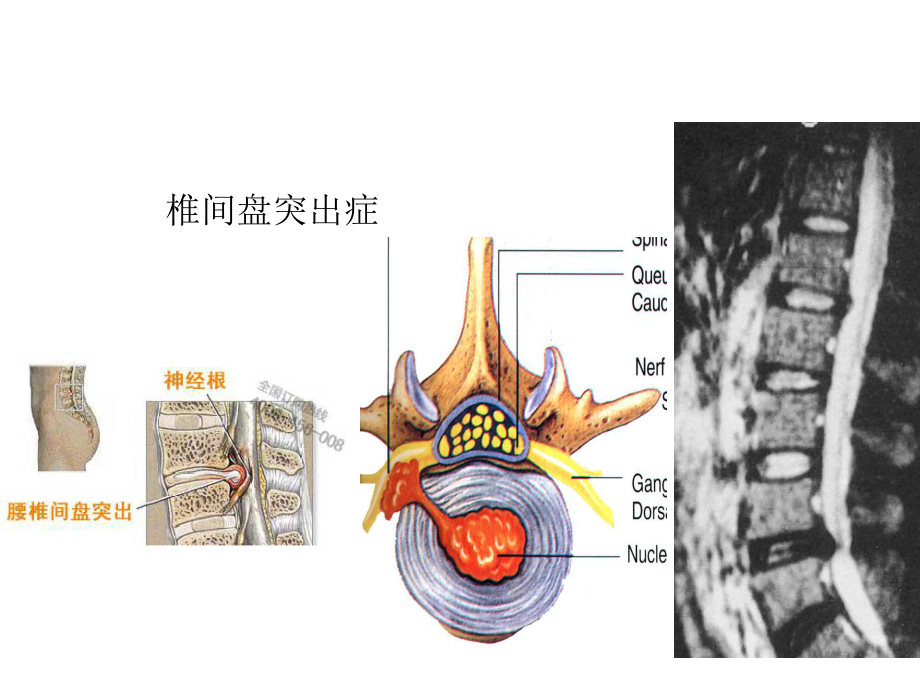 一次性纤维环缝合器课件.ppt_第3页