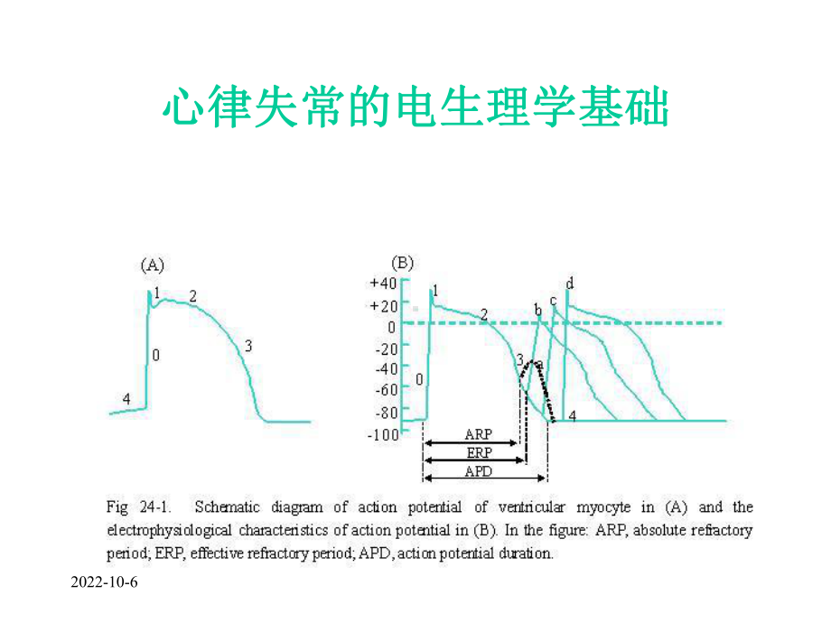 第24章抗心律失常药课件.ppt_第3页