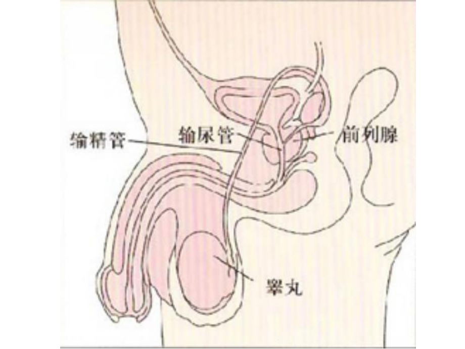 第四节良性前列腺增生病人的护理(共22张)课件.pptx_第3页