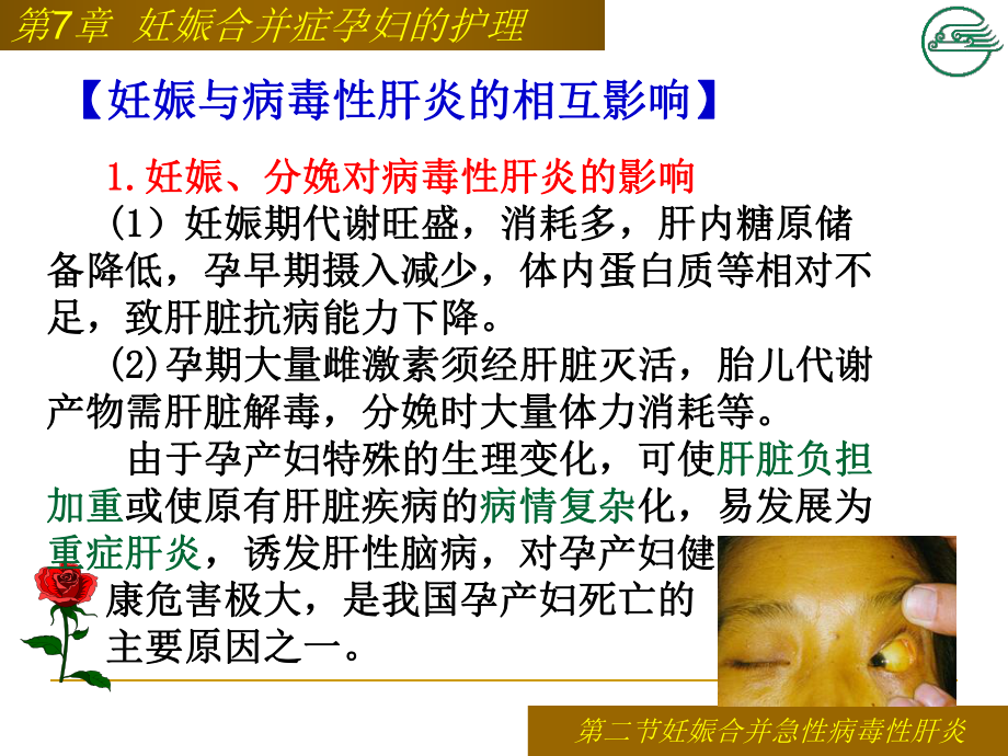 第二节妊娠合并病毒性肝炎患者的护理课件.ppt_第2页