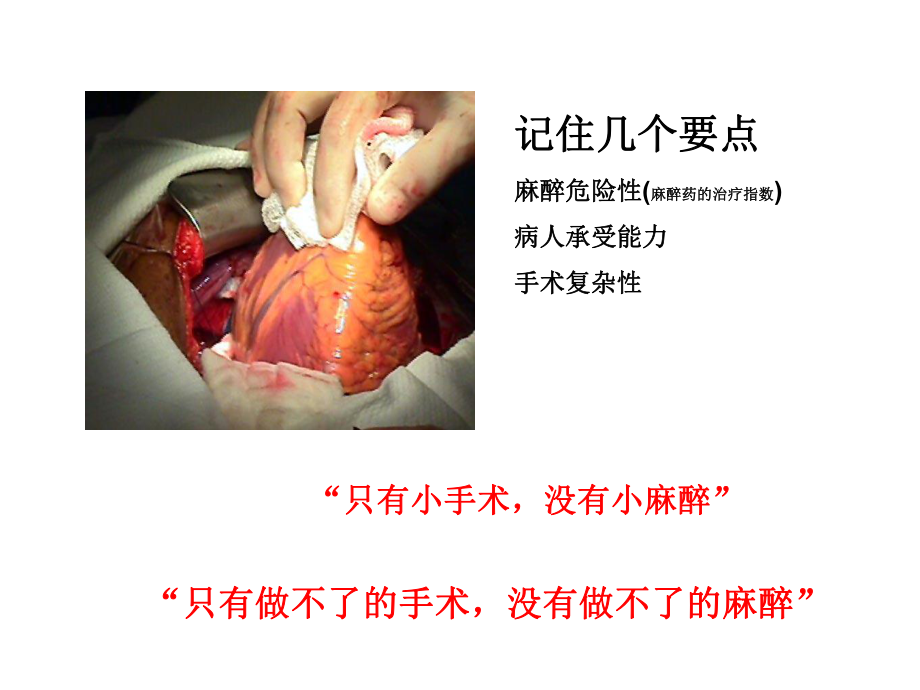 麻醉病人护理课件.ppt_第3页