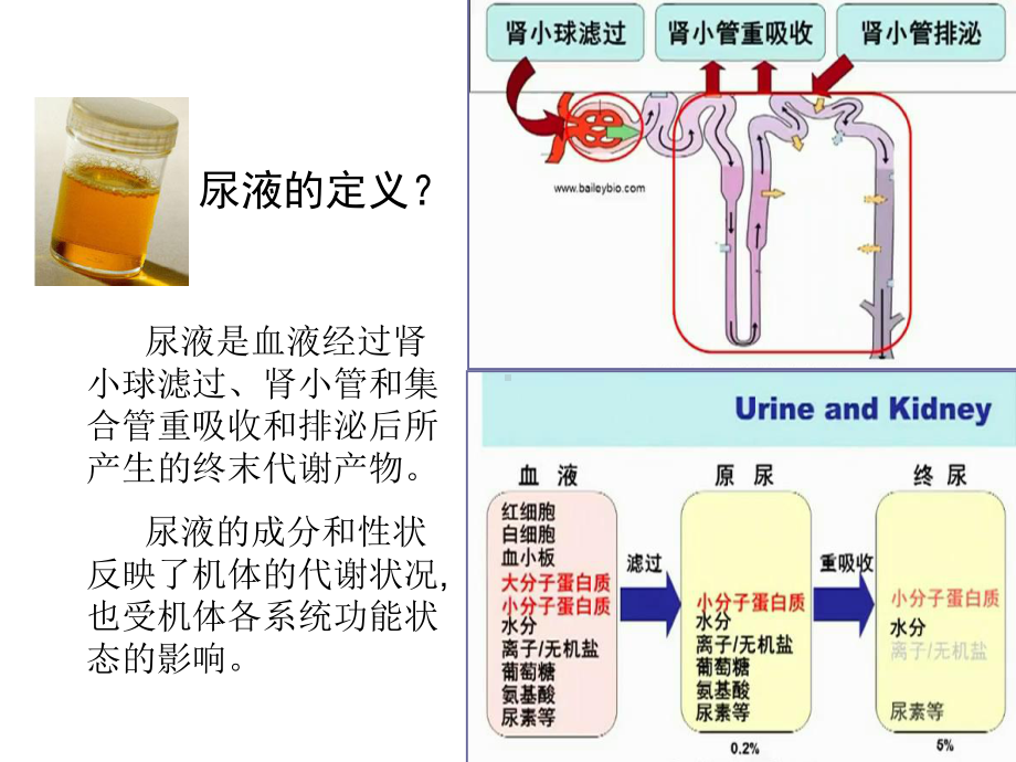 [诊断学]尿液检测课件.ppt_第3页