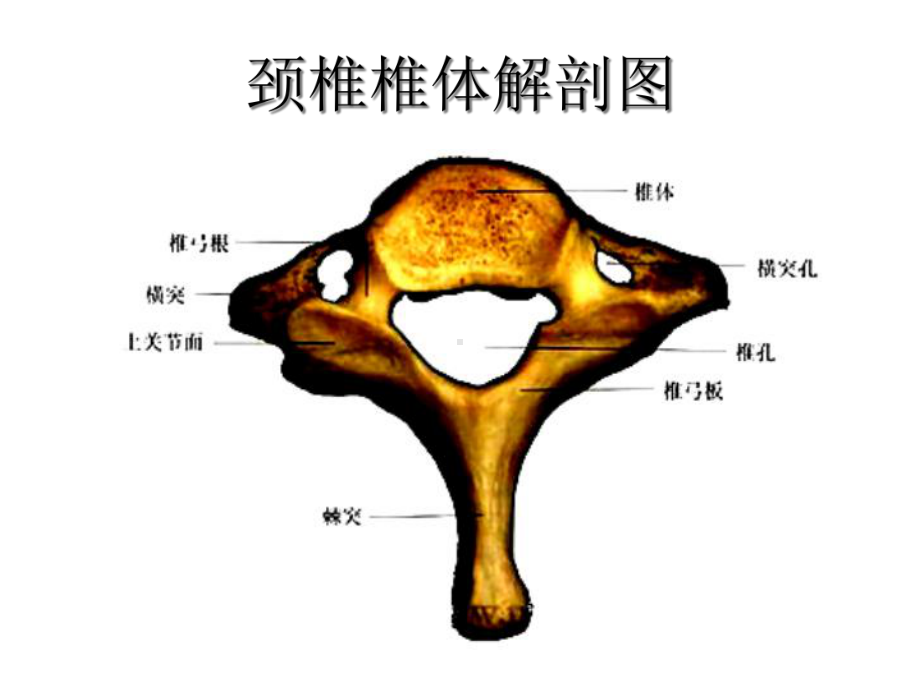 颈椎前路手术配合康锡梁完整版课件.ppt_第2页