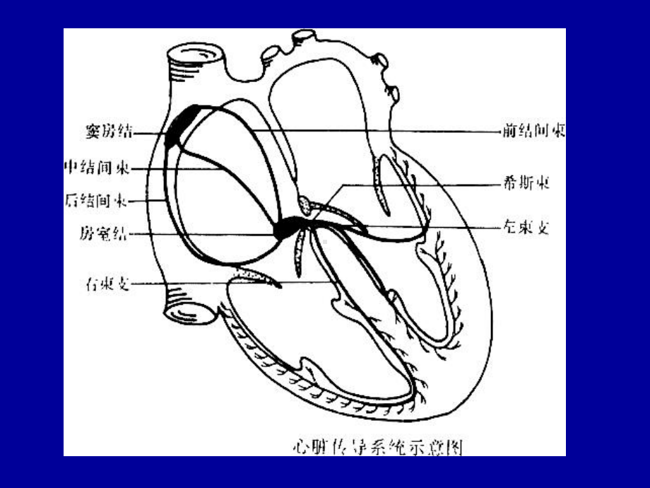 第二节心律失常课件.ppt_第3页